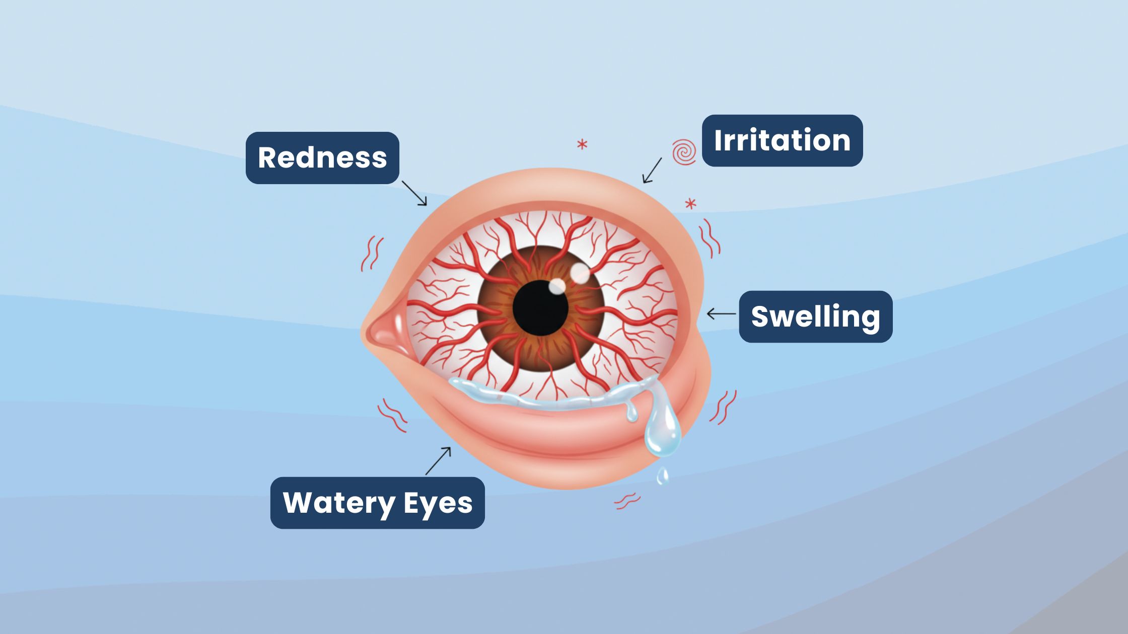 Best Astigmatism Doctor In Delhi